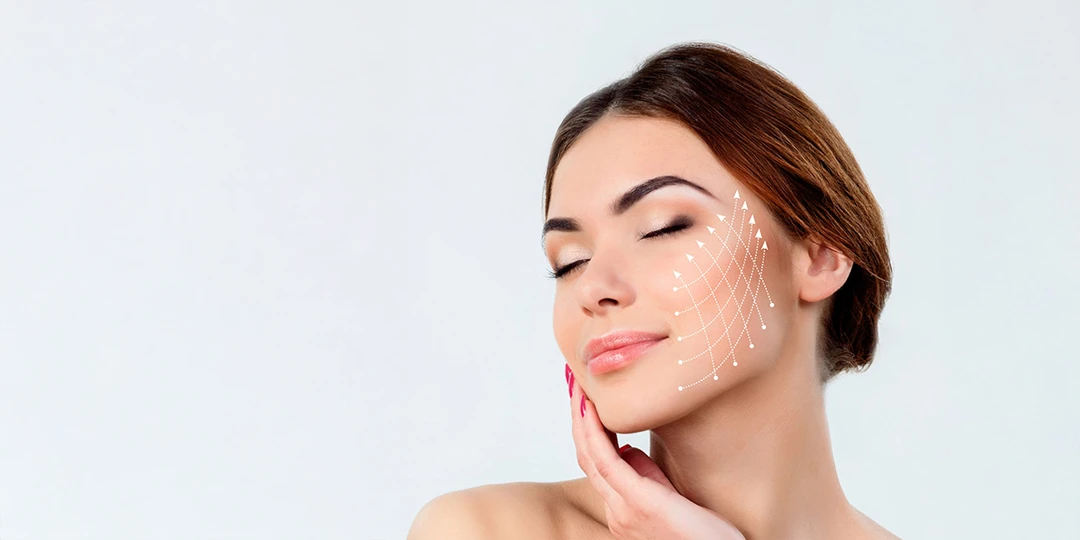 Cuidados luego del tratamiento con hilos tensores