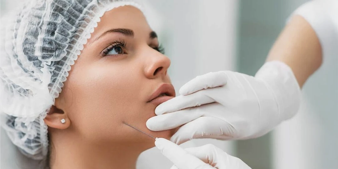 Hilos tensores Cómo combate las arrugas y la flacidez