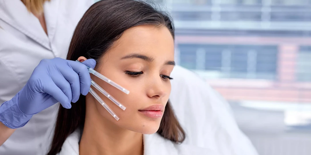 Qué son los hilos tensores